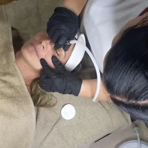 mikrodermoabrazija obuka akademija besos